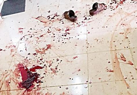 رفضت منحه الموافقة للزواج من أخرى ففجر رأسها بحجر ضخم 1 DSQ