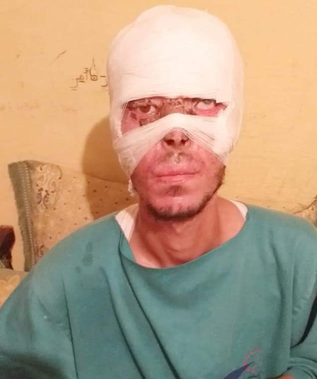 تيفلت :"حسن" يناشد القلوب الرحيمة لمساعدته على العلاج وإعالة طفليه. 1 FB IMG 15554909240033