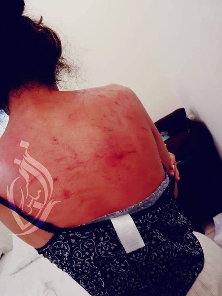 خطير….مواطن سعودي يعتدي على زوجته المغربية 1 IMG 20190416 WA0087