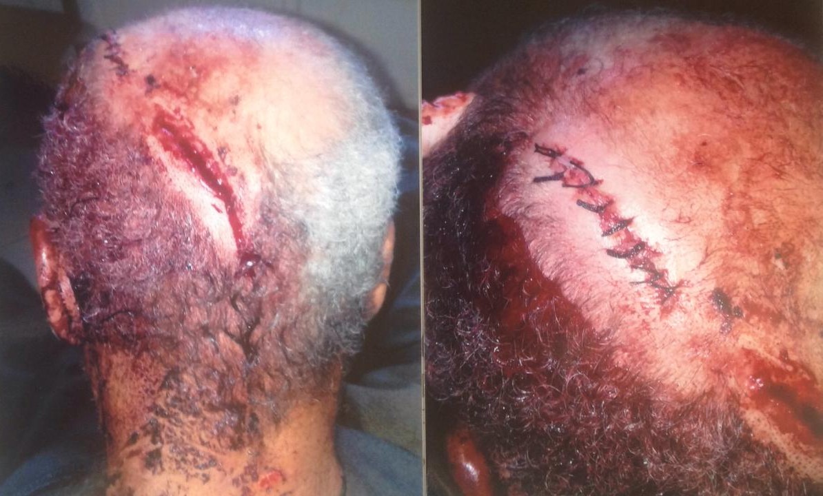 "قصة يوسف" كادت تتكرر قتلا في أربعاء الغرب 1 IMG 20190726 WA00202