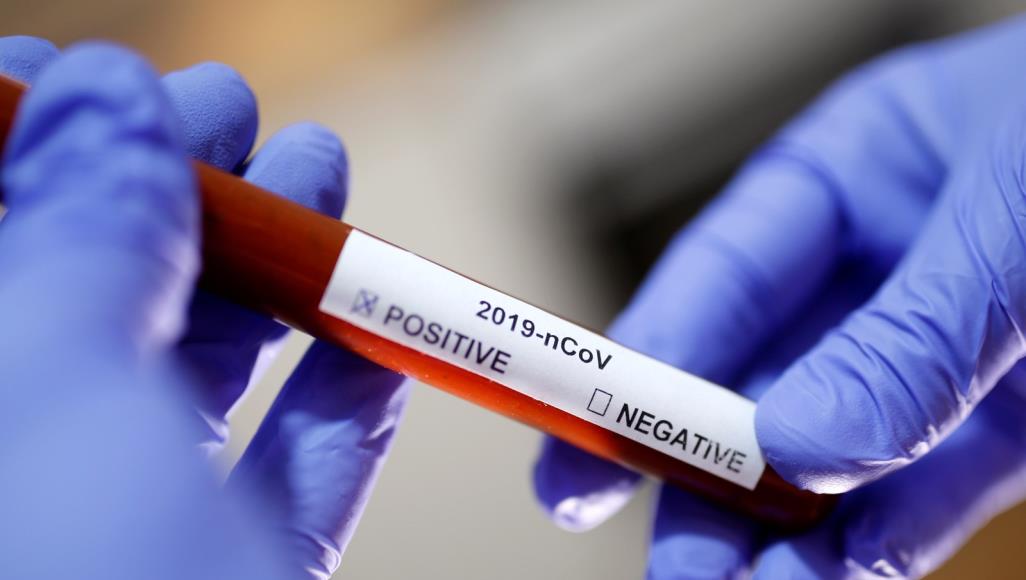 حالة خامسة مصابة بفيروس كورونا بالخميسات 1 580