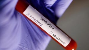 2020 05 12T180549Z 1086218614 RC26NG9U1R1X RTRMADP 3 HEALTH CORONAVIRUS GREECE MIGRANTS 5