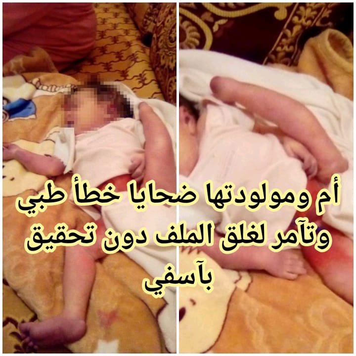 أم ومولودتها ضحايا خطأ طبي وتآمر لغلق الملف دون تحقيق بآسفي 1 IMG 20200510 WA0173