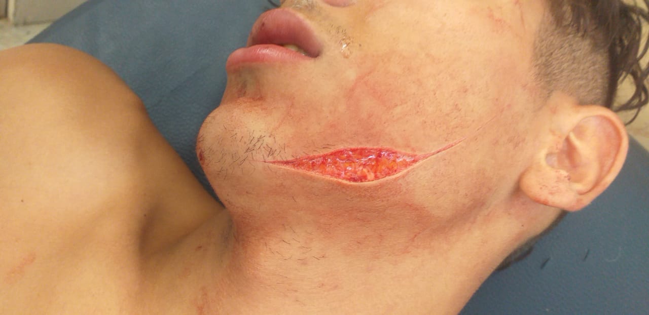 انتهاء الحملة الانتخابية بمقاطعة الفداء على إيقاعات دامية و حزب الحمامة في قفص الاتهام من جديد 1 IMG 20210908 WA0001