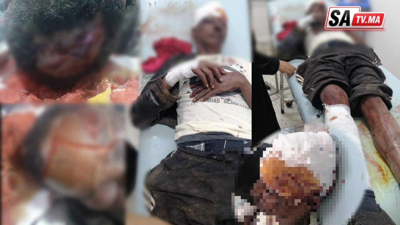 الخميسات...فراقشية يدخلون مواطن بالحجامة في غيبوبة. 1 IMG 20220806 WA0045