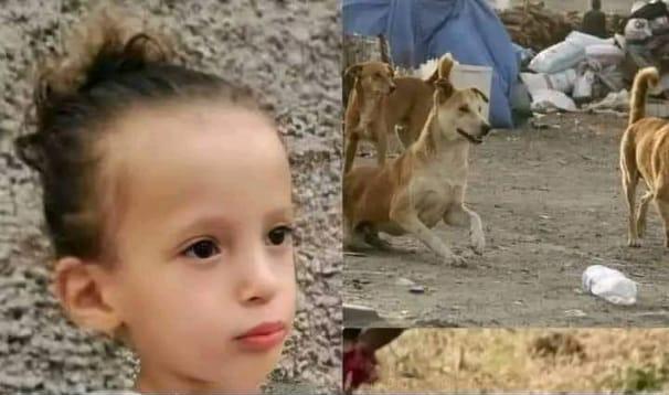 " نجاة" مأساة طفلة نهشت لحمها الكلاب الضالة بواد سوس 1 IMG 20220915 WA0006