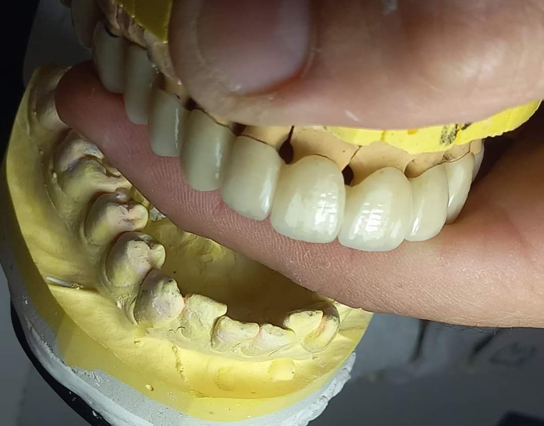 الرباط.. جمع عام لتأسيس مكتب جهوي للفيدرالية الوطنية لصانعي ومركبي الأسنان بالمغرب في هذا التاريخ 1 IMG 20221011 WA0034