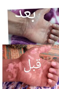 1000176478 3 1000176478