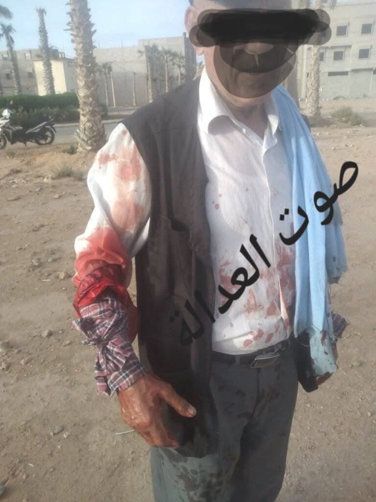 العيون: سائق سيارة اجرة يتعرض لاعتداء خطير بالسلاح الأبيض 2 1000337729