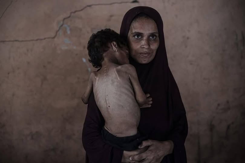 بينهم 154 طفلا.. 459 شهيدا بسبب المجاعة وسوء التغذية بغزة 1 34a23ad23b9a5e3b0d1601b2079b8305